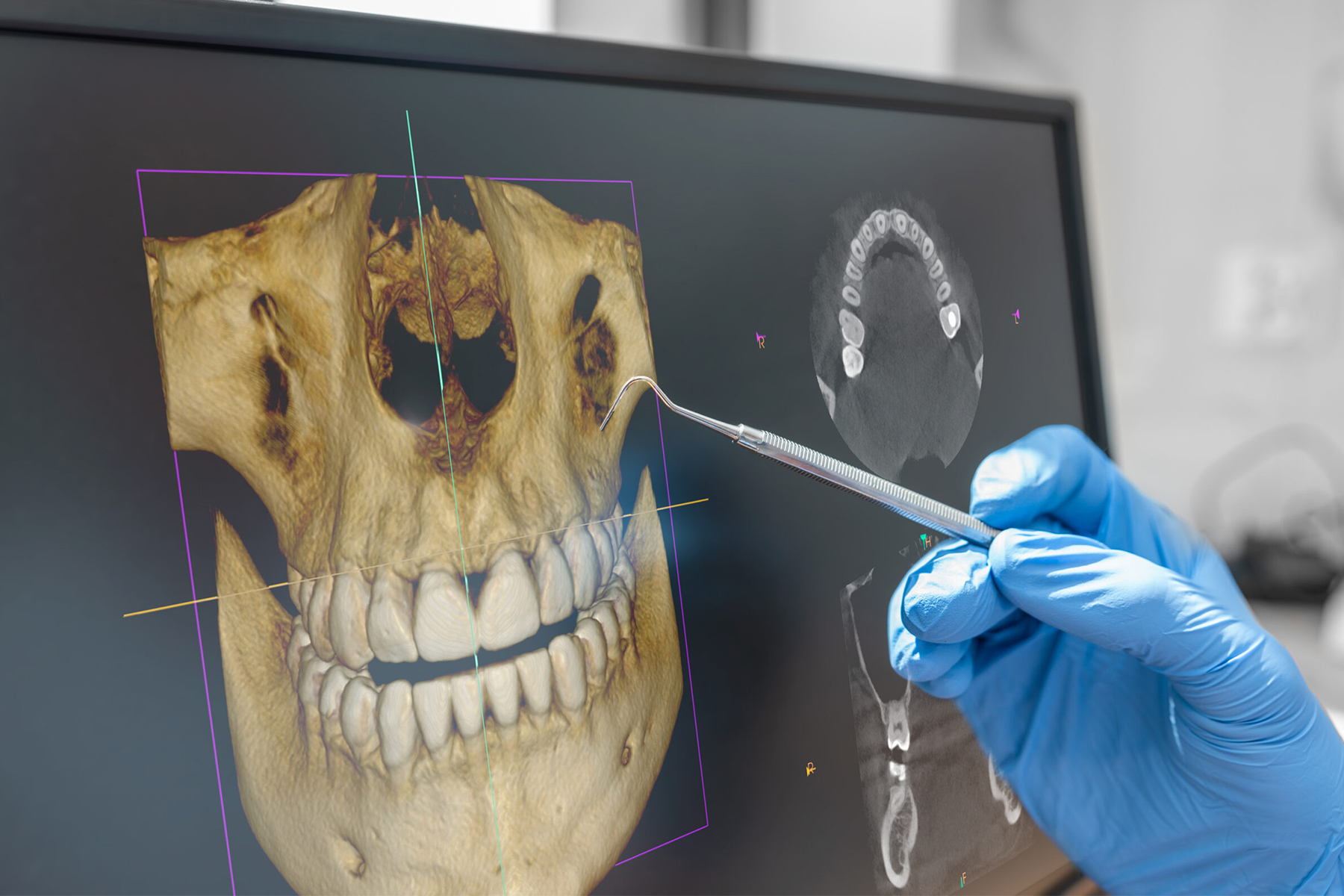 Recursos de raio X e tomografia disponíveis no mesmo prédio da clínica